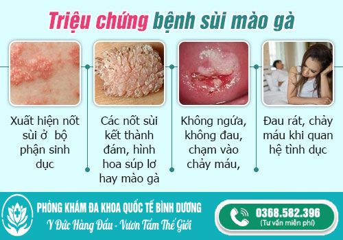 triệu chứng bệnh sùi mào gà