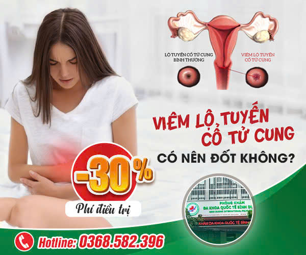 Ảnh hưởng của viêm lộ tuyến cổ tử cung đối với sức khỏe nữ giới - Thách thức và giải pháp toàn diện