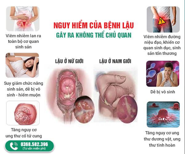 nguy hiểm của bệnh lậu