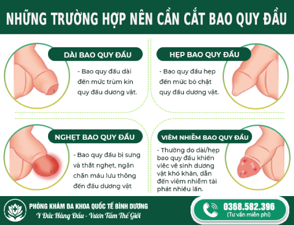 khi nào cần cắt bao quy đầu ở bình dương