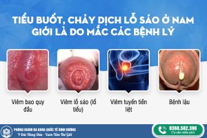 tiểu buốt là bệnh gì