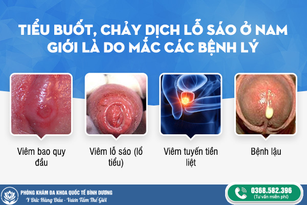 tiểu buốt là bệnh gì